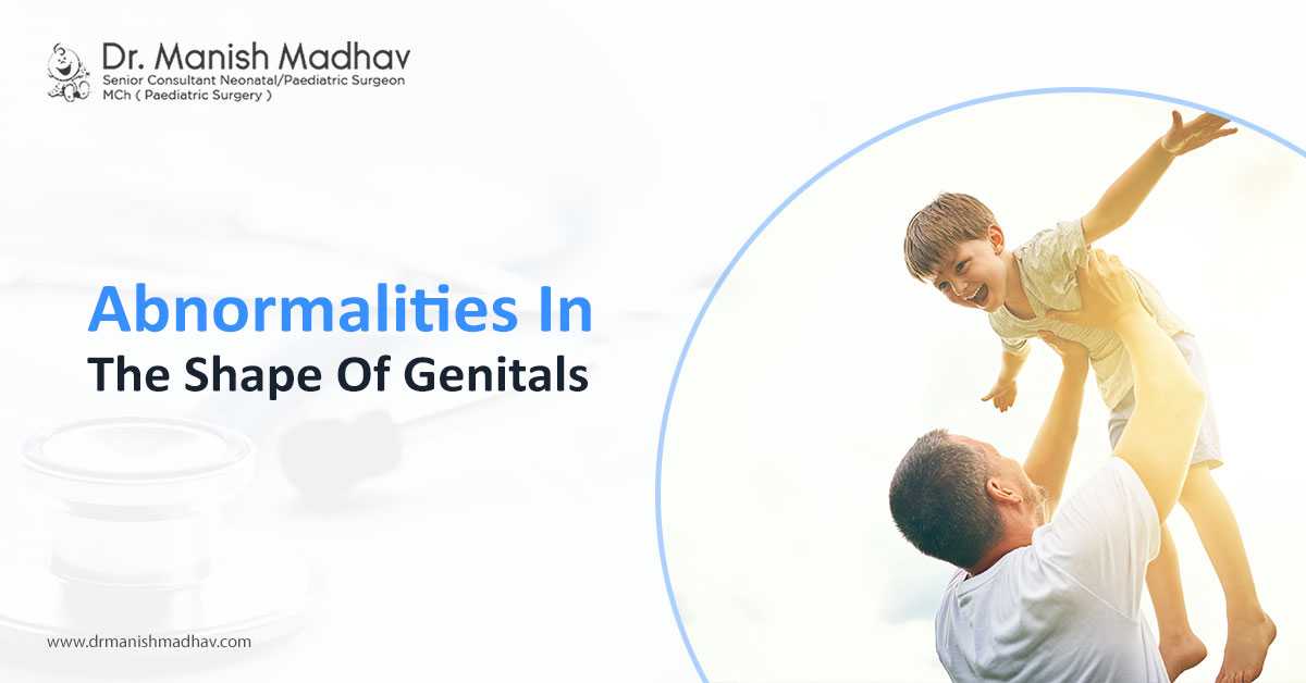 Abnormalities in the shape of genitals