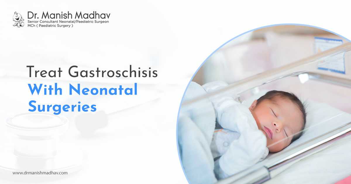 Treat Gastroschisis With Neonatal Surgeries