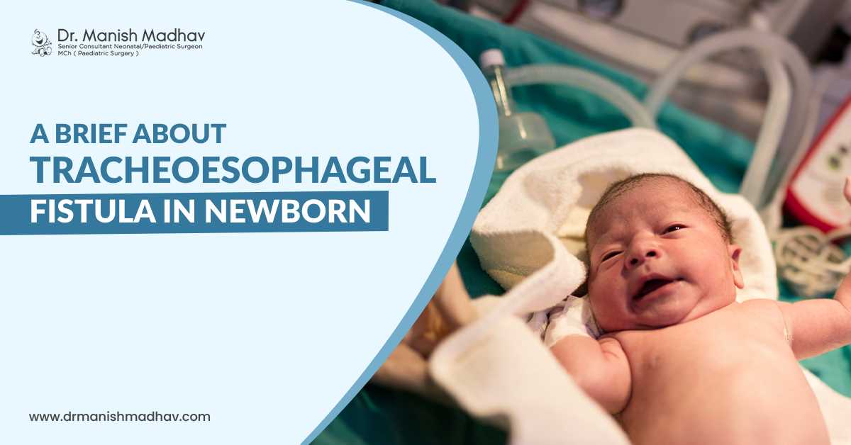 A Brief About Tracheoesophageal Fistula In Newborn