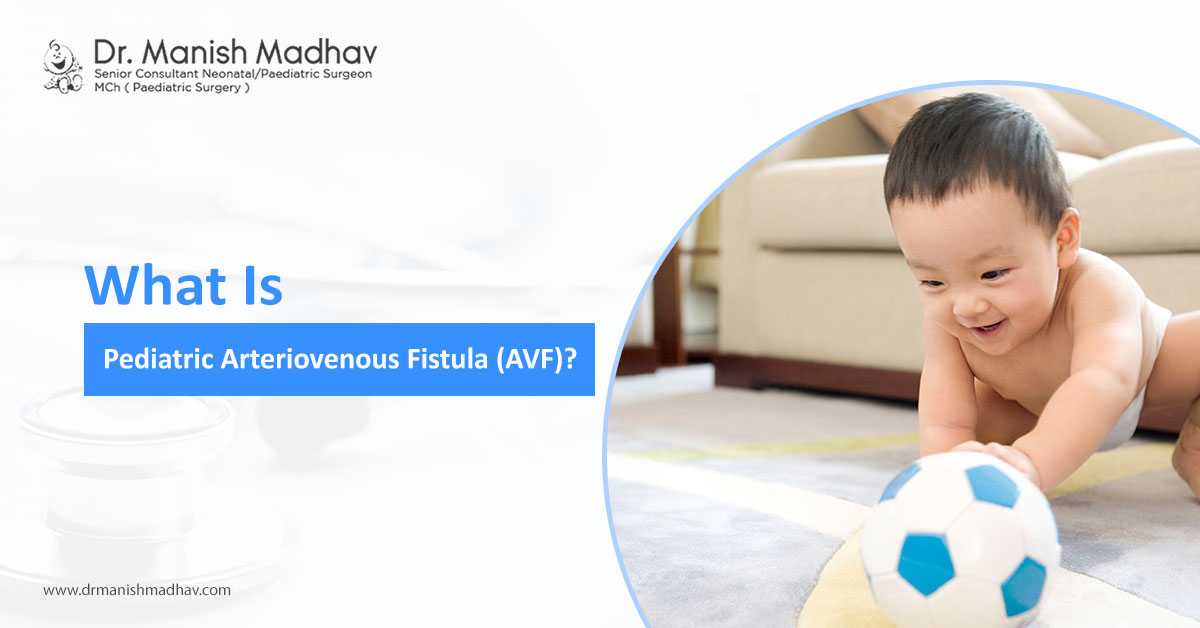 What Is Pediatric Arteriovenous Fistula?