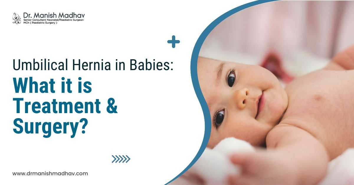 Umbilical Hernia in Babies: What is the Treatment & Surgery?