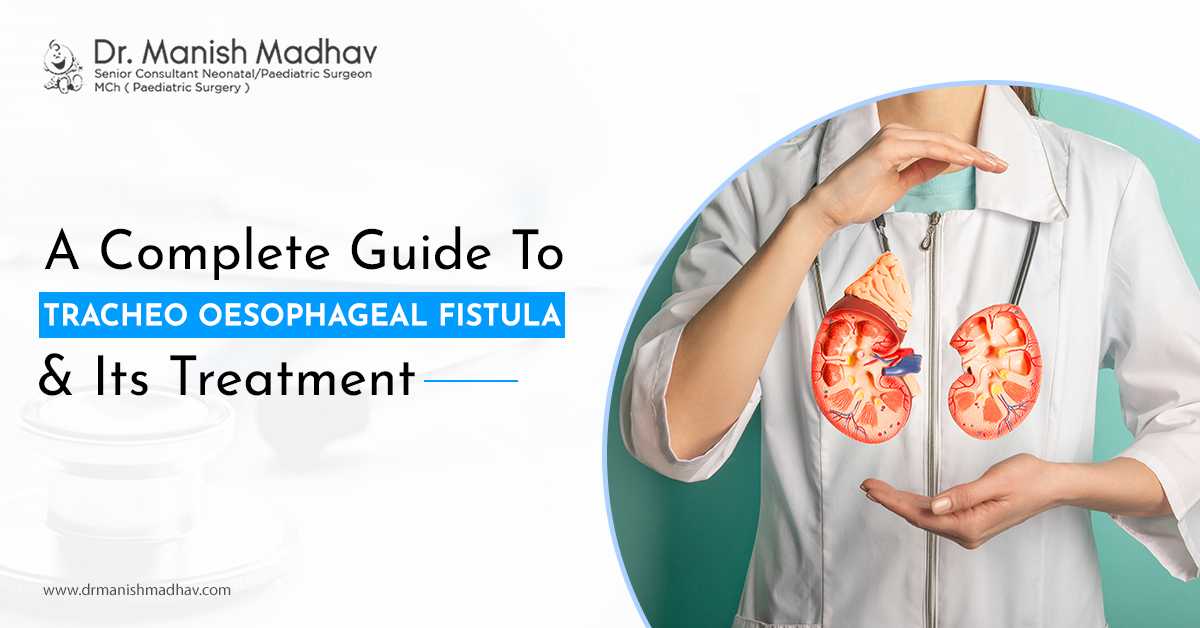 A Complete Guide To Tracheo Oesophageal Fistula & Its Treatment